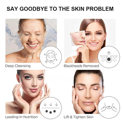 Ultrasonic Skin Scrubber Device (2026 Model)